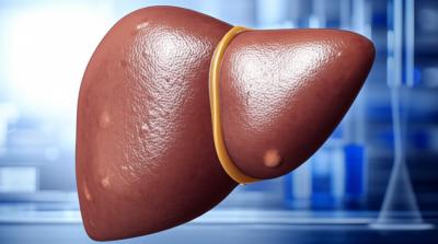 Fígado Gorduroso: A Verdade Nua e Crua (Review Completo)